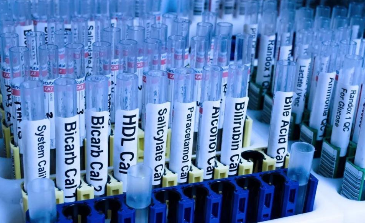 平行樣品一般為三,平行試驗(yàn)也為三